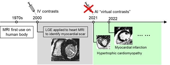 磁共振成像IV对比的背景，以及人工智能“虚拟对比”新时代的兴起。